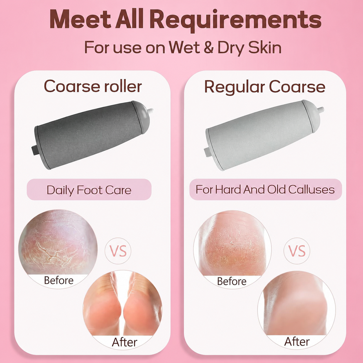 Flexi Lush™ Calysus Remover